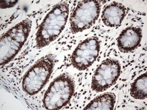 EWSR1 / EWS Antibody (aa256-447, clone OTI2B3)