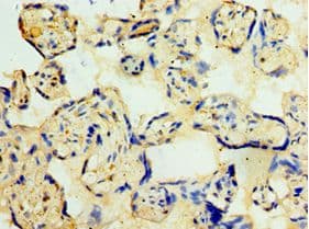 CDK16 / PCTAIRE Antibody (aa277-496)