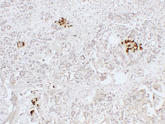 GCG / Glucagon Antibody (clone ABT-GCG)