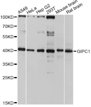 Polyclonal Rabbit anti-Human GIPC1 / GIPC Antibody (WB)