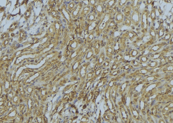 PEX16 Antibody