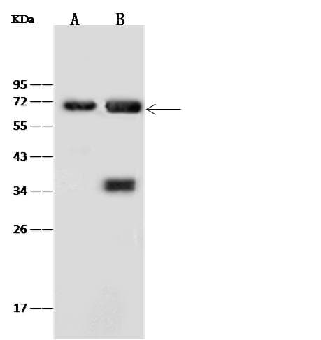 ANXA6/Annexin A6/Annexin VI Antibody (Preservative Free)