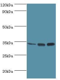 Polyclonal Rabbit anti-Human M-PST / STM Antibody (aa1-295, IHC, WB)
