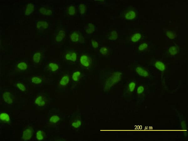 UBCH / UBE2H Antibody (clone 3C4-1A2)