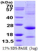 Human ATF3 Protein (Recombinant)