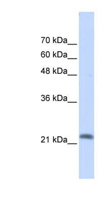 Polyclonal Rabbit anti-Human RRP22 / RASL10A Antibody (aa35-84, WB)
