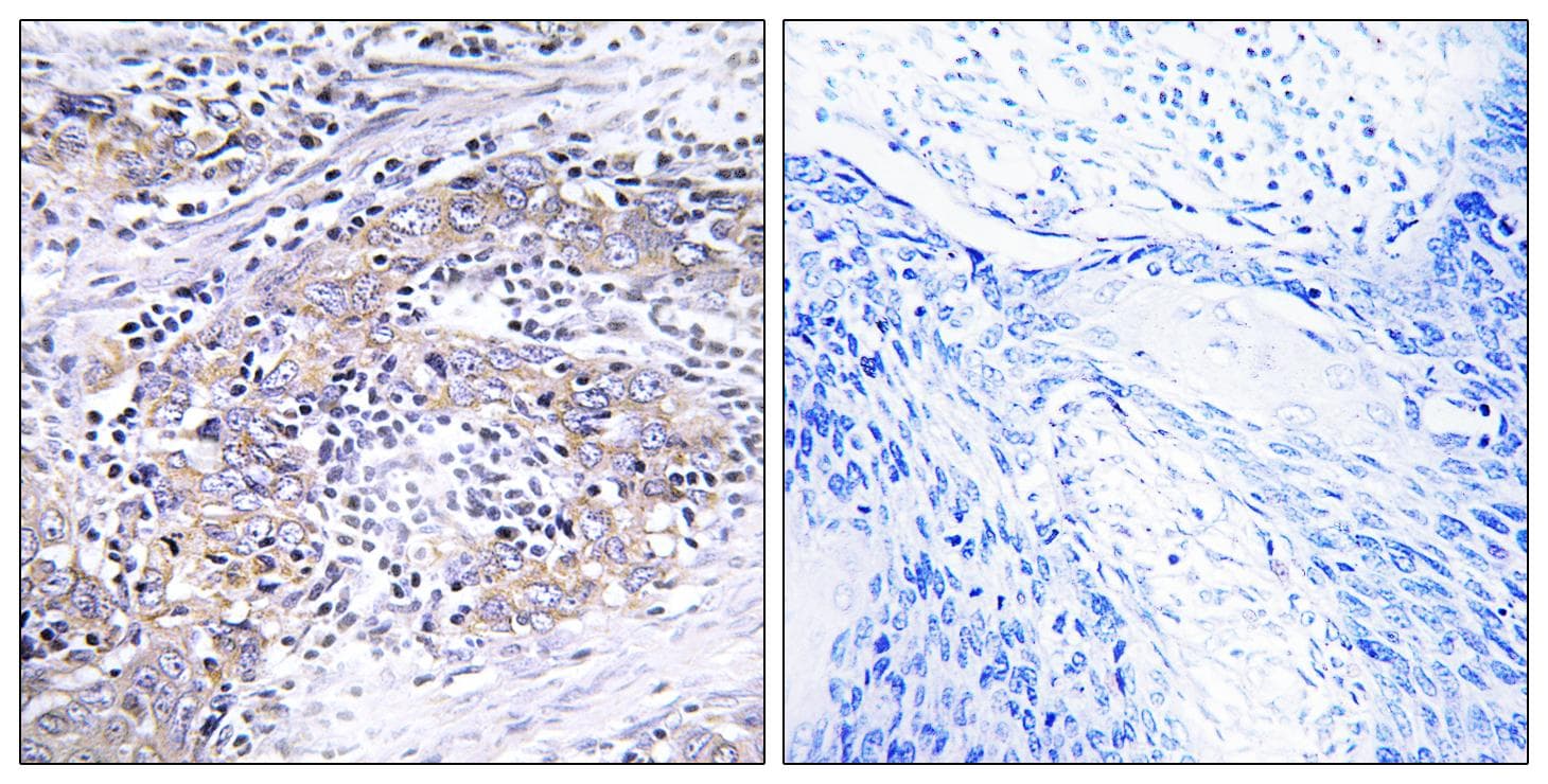 CLN6 Antibody
