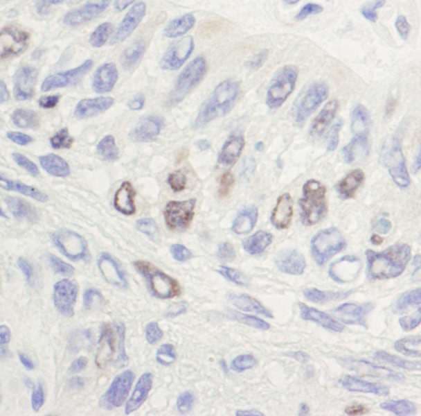 TOP2A / Topoisomerase II Alpha Antibody (aa1500-C-term)