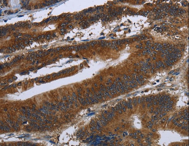 ARHGEF12 Antibody