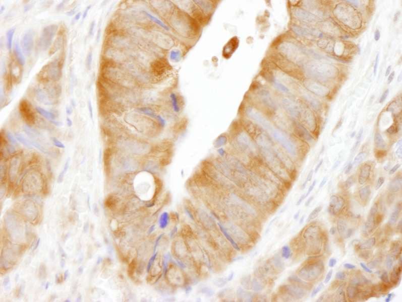 IHC-plus™ Polyclonal Rabbit anti-Human CAD Antibody (aa1850-2000, IHC, WB)