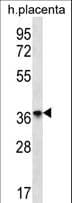 OR8D4 Antibody (aa280-308)