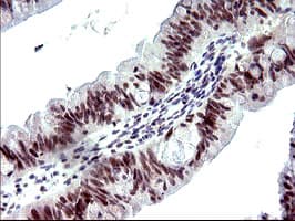 Monoclonal Mouse anti-Human PMS2 Antibody (clone OTI4B7, IHC, WB)