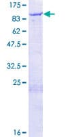 Human HEC1 / NDC80 Protein (Recombinant GST)