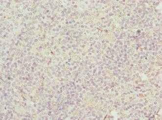 Polyclonal Rabbit anti-Human M6PR Antibody (WB)
