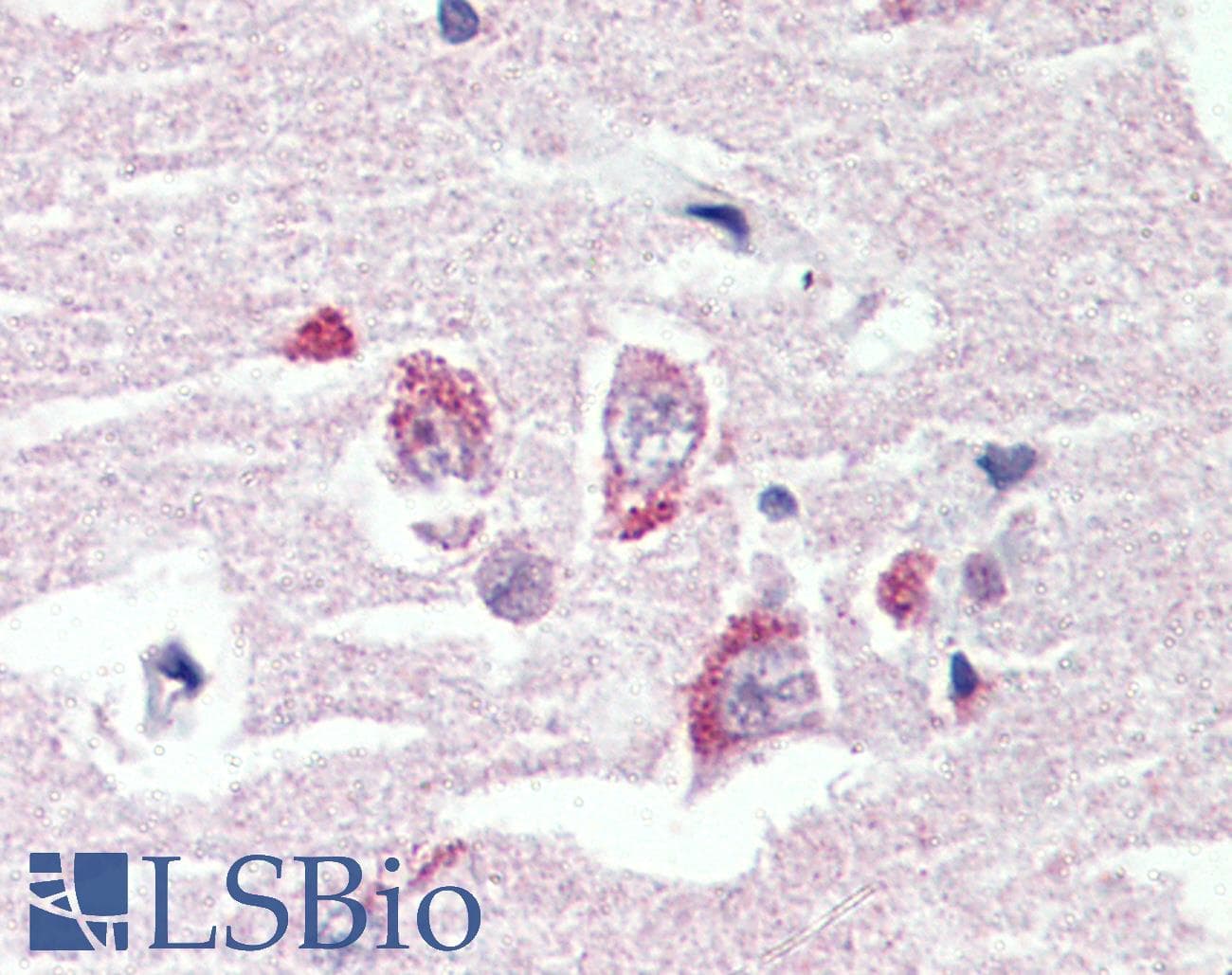 IHC-plus™ Polyclonal Rabbit anti-Human ADGRV1 / GPR98 Antibody (N-Terminus, IHC)