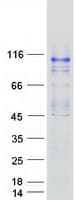 Human OCRL Protein (Recombinant Myc-DDK (Flag))