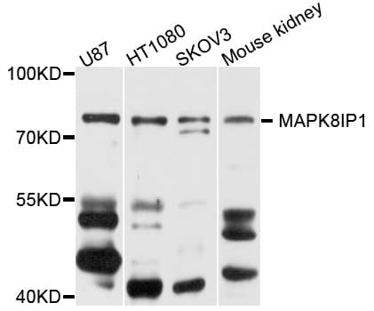 MAPK8IP1 / JIP1 Antibody (AP)