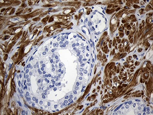 Monoclonal Mouse anti-Human C1orf111 Antibody (clone OTI2A9, IHC, WB)