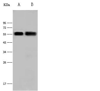 MICB Antibody (Preservative Free)
