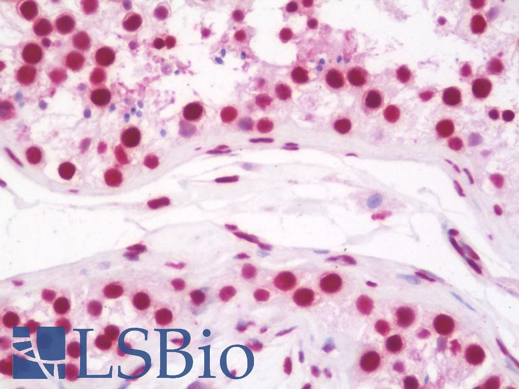 IHC-plus™ Polyclonal Rabbit anti-Human HNRNPH2 / hnRNP H2 Antibody (aa311-340, IHC, WB)