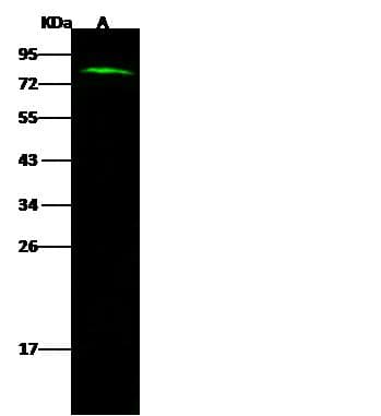 CTAGE1 / CTAGE Antibody (Preservative Free)