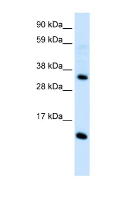 CCL18 / PARC Antibody (C-Terminus)
