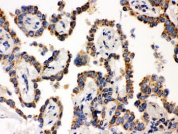 WAS / WASP Antibody