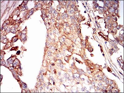 SDC1 / Syndecan 1 / CD138 Antibody (aa28-171, clone 1A3H4)