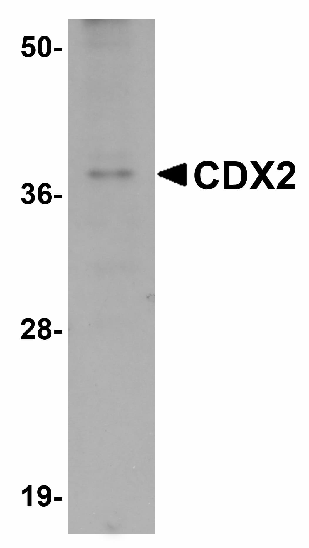 IHC-plus™ CDX2 Antibody