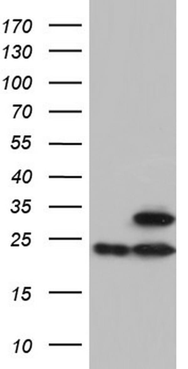 ATP5O Antibody (aa24-213, clone OTI2E9, Carrier-free)