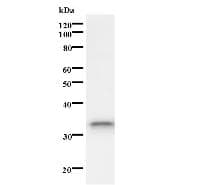 ISL2 / Islet 2 Antibody (clone 203C5a)