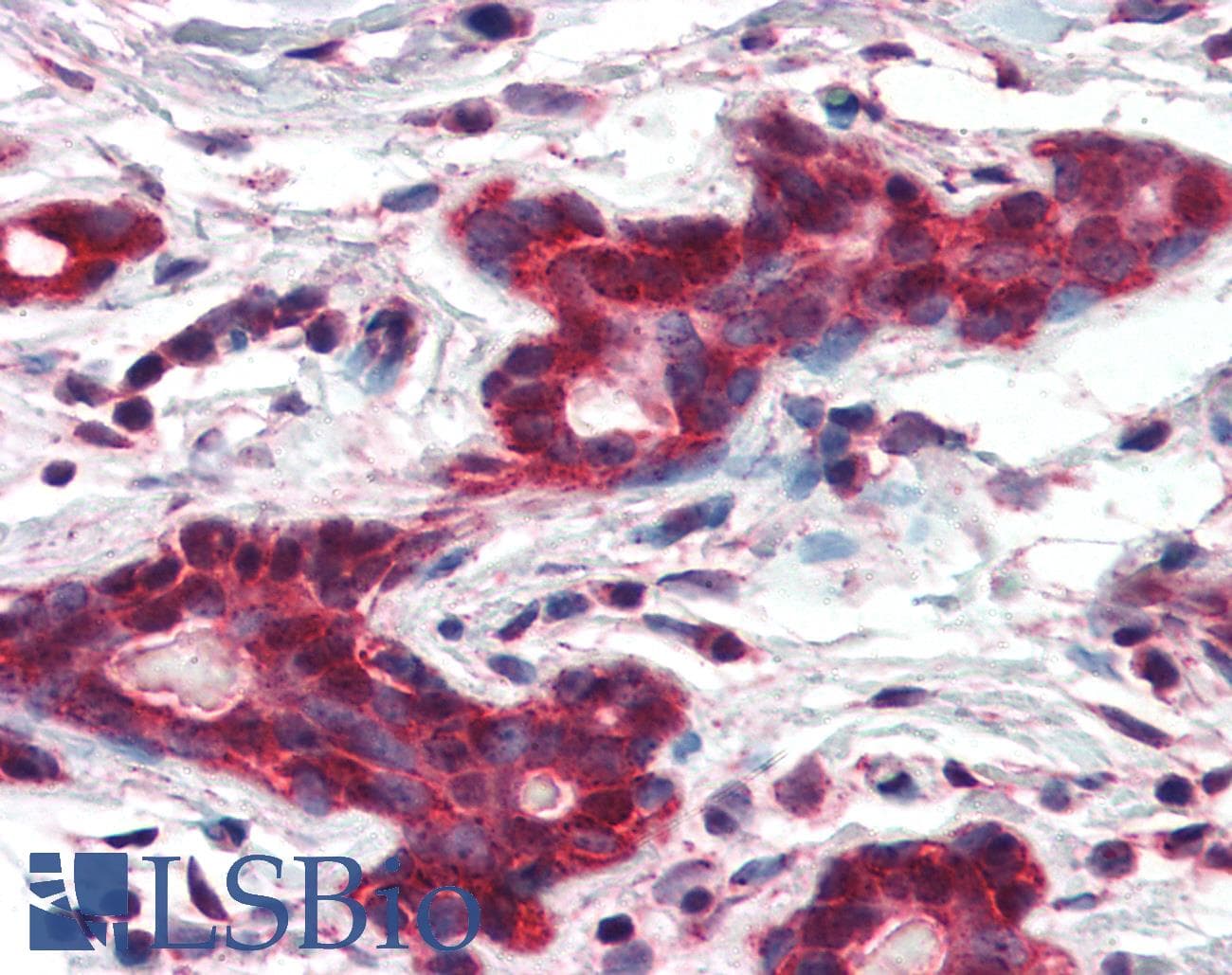 IHC-plus™ MMP14 Antibody (aa160-173)