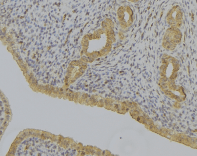 Polyclonal Rabbit anti-Human DDH / AKR1C1 Antibody (IHC, WB)