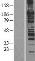 Human MCM6 Protein (Over-Expression Lysate Myc-DDK (Flag))
