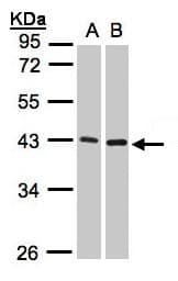 IHC-plus™ MMP3 Antibody