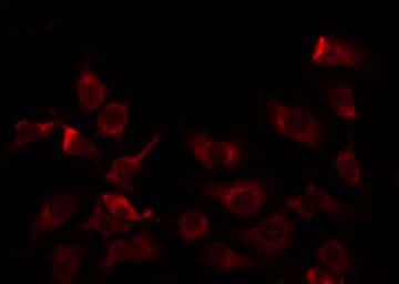 Polyclonal Rabbit anti-Human MRPL9 Antibody (IF, WB)