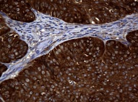 NME1 / NM23 Antibody (clone OTI2H10)