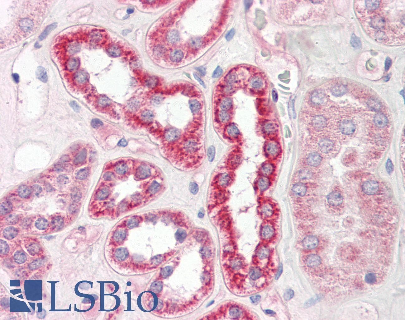 PLS3 / T Plastin Antibody (aa503-552)