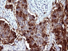 SERPINB3 Antibody (clone OTI1C10)
