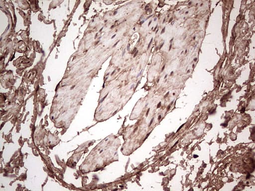 LGALS3 / Galectin 3 Antibody (clone OTI2F1)