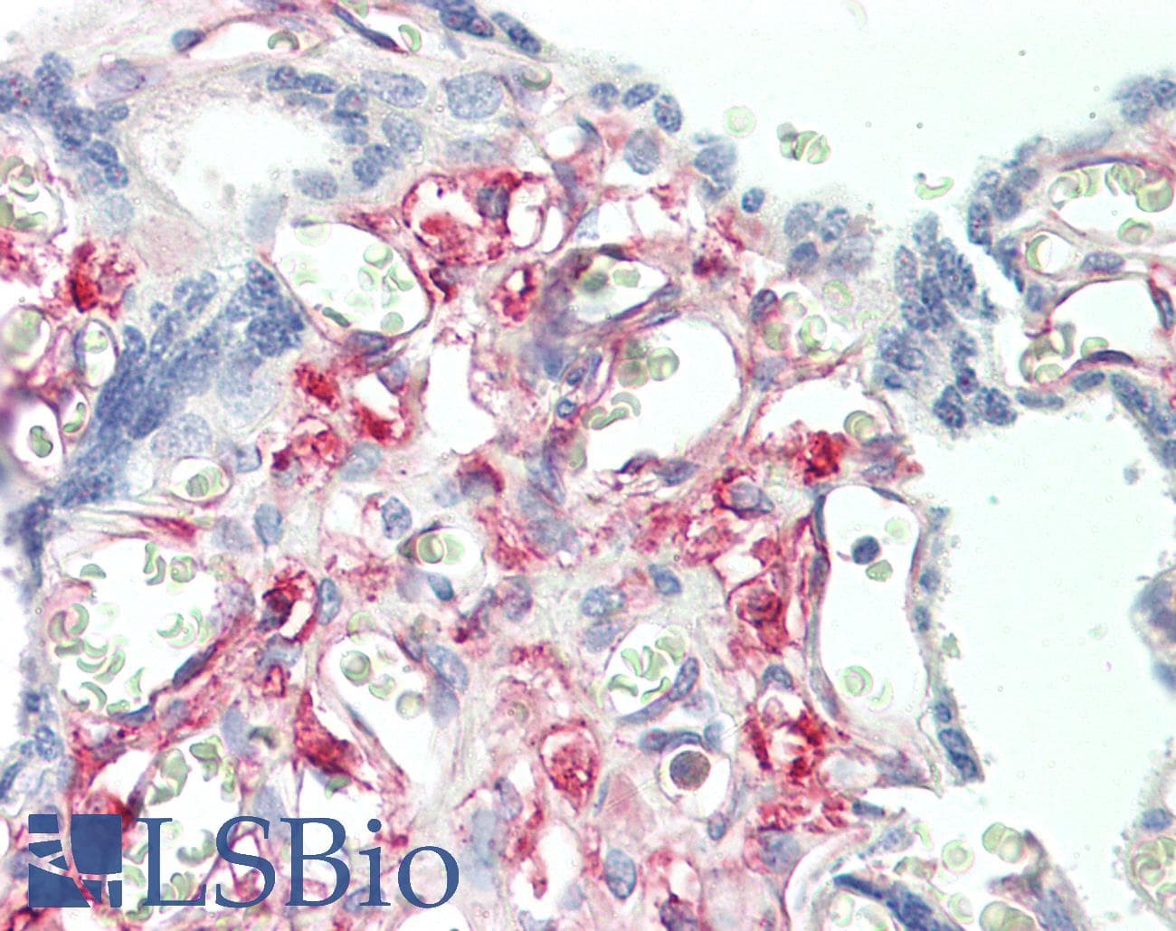 IHC-plus™ Polyclonal Rabbit anti-Human PRKCDBP / CAVIN3 Antibody (C-Terminus, IHC, WB)