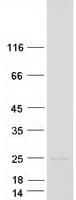 Human COQ7 Protein (Recombinant Myc-DDK (Flag))