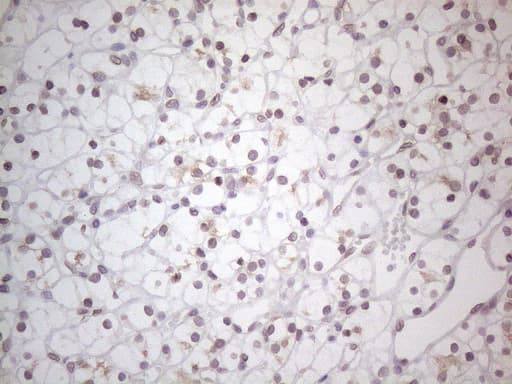 TLK2 Antibody (aa1-296, clone OTI2D10)