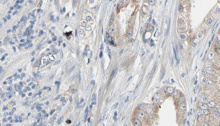 Polyclonal Rabbit anti-Human HMGCS1 / HMG-CoA Synthase 1 Antibody (IHC, IF, WB)