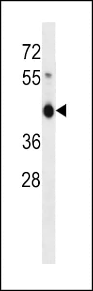 ZNF843 Antibody (aa112-141)