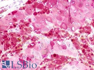 PathPlus™ GPR52 Antibody (N-Terminus)