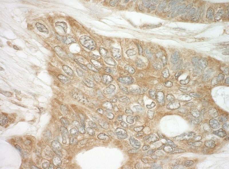 DAP-5 / EIF4G2 Antibody (aa125-175)