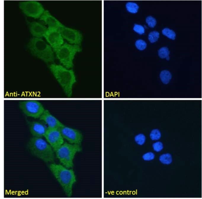 ATXN2 / SCA2 / Ataxin-2 Antibody (aa479-489)