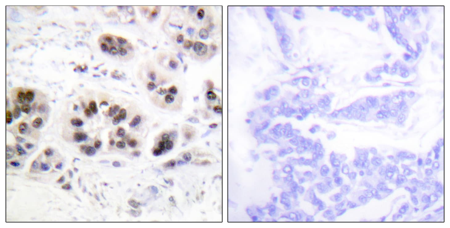 Polyclonal Rabbit anti-Human Histone H2B Antibody (Acetyl-Lys5, IHC)