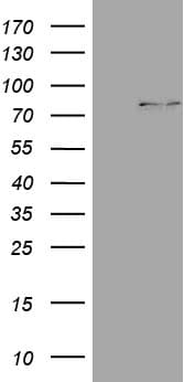 CPT1B Antibody (aa187-440, clone OTI6B8, Carrier-free)